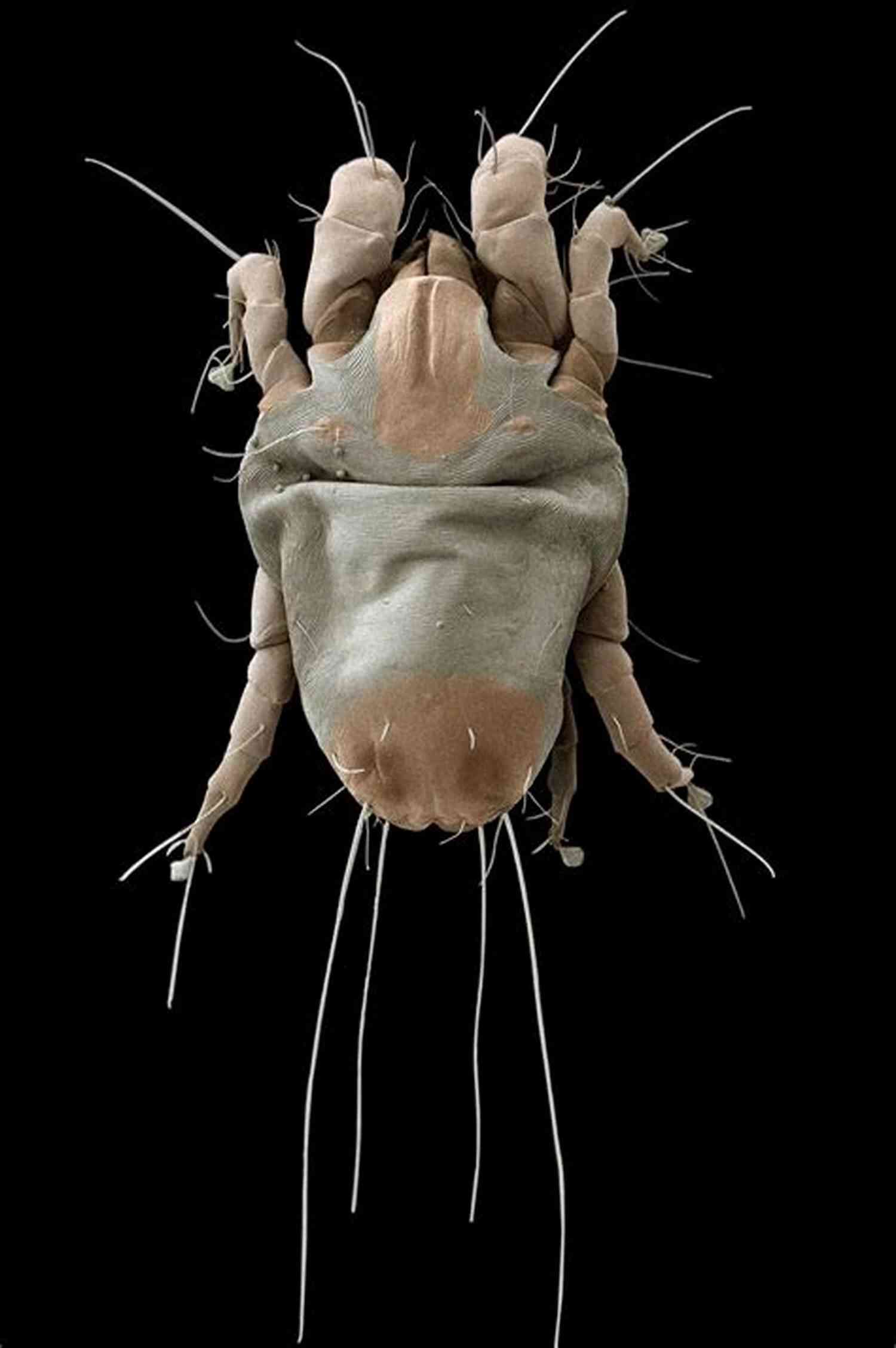 House Dust Mites Under The Microscope HOUSE DUST MITES: A Threat To Human Health